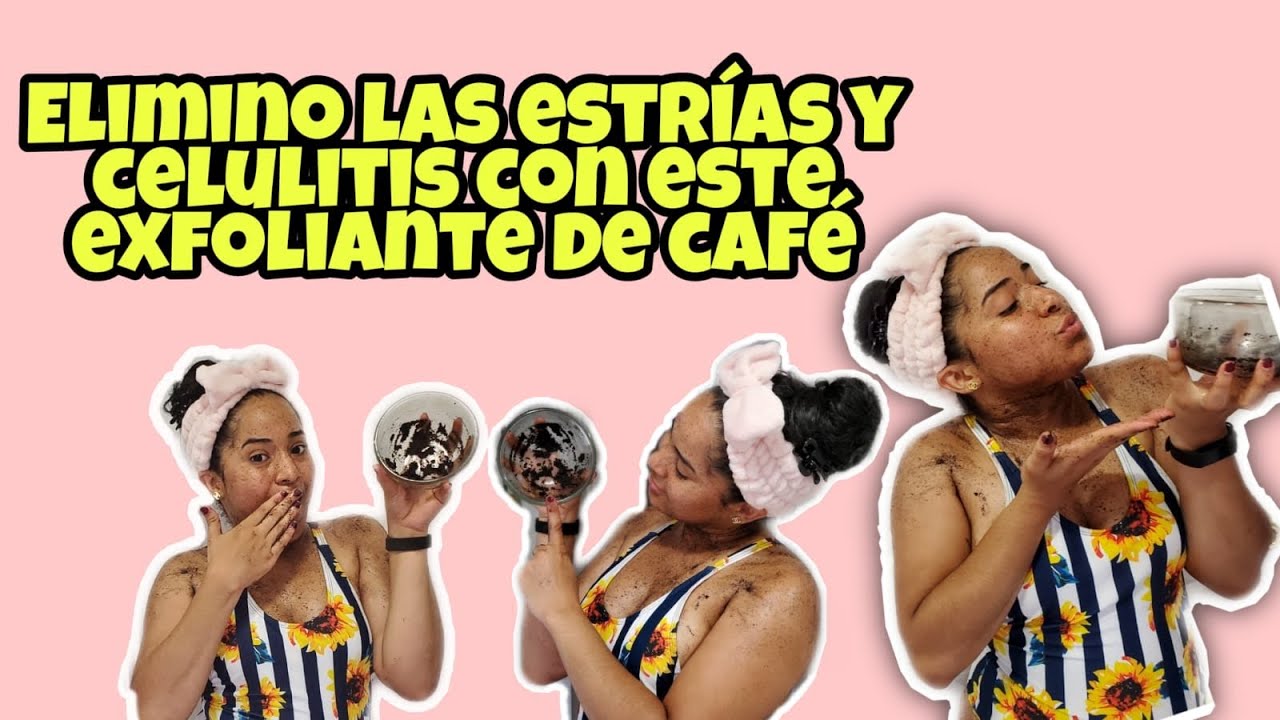 Café y aceite de oliva para reducir las estrías