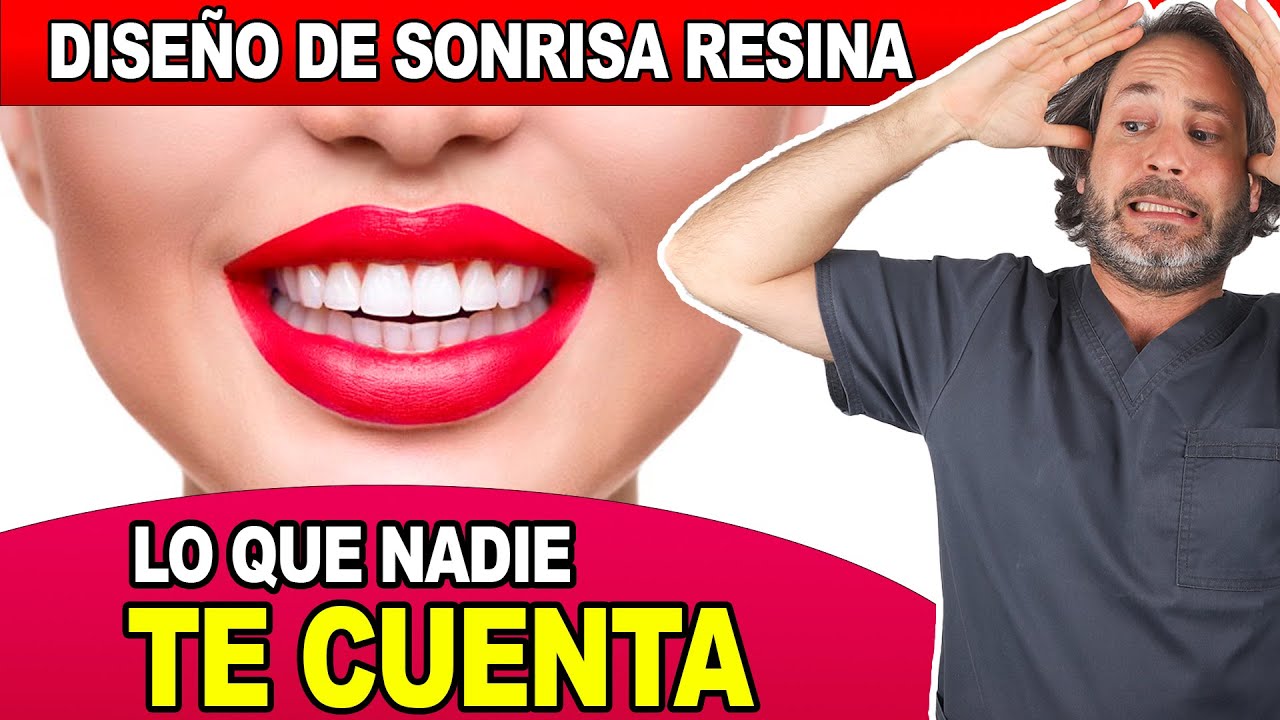 dientes de resina ventajas y desventajas