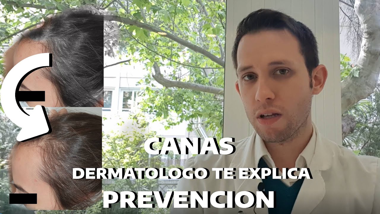 Cómo prevenir las canas prematuras sin mucho esfuerzo