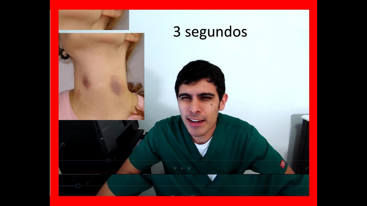 Consejos efectivos para eliminar los chupetones del cuerpo