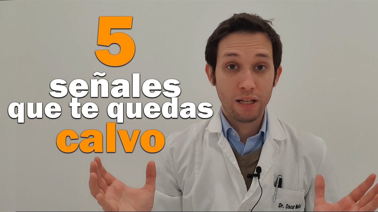 Cuándo es común comenzar a quedarse calvo