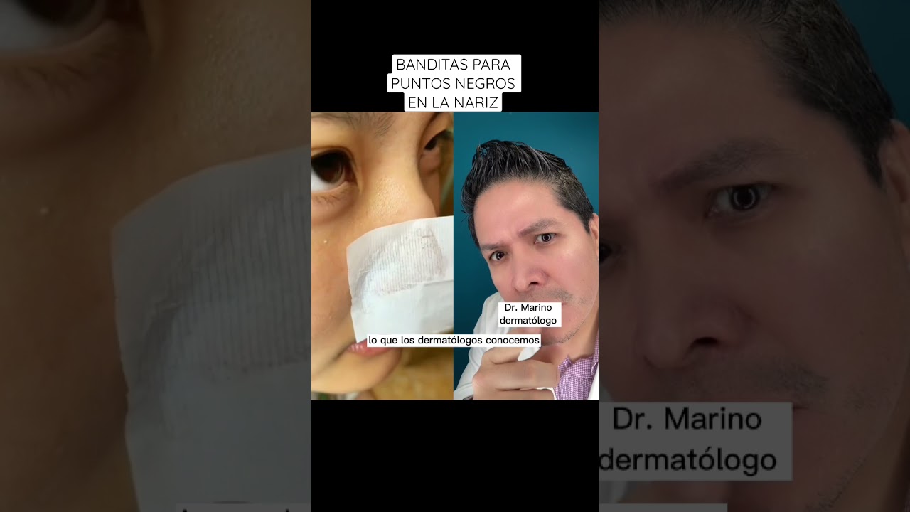 Elimina las espinillas de tu nariz siguiendo estos consejos