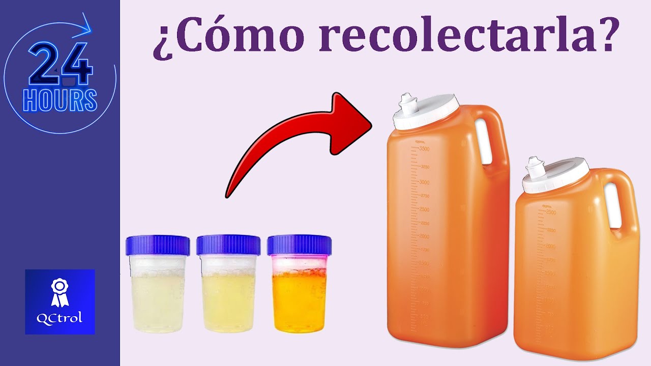 valores normales de histamina en orina de 24 horas