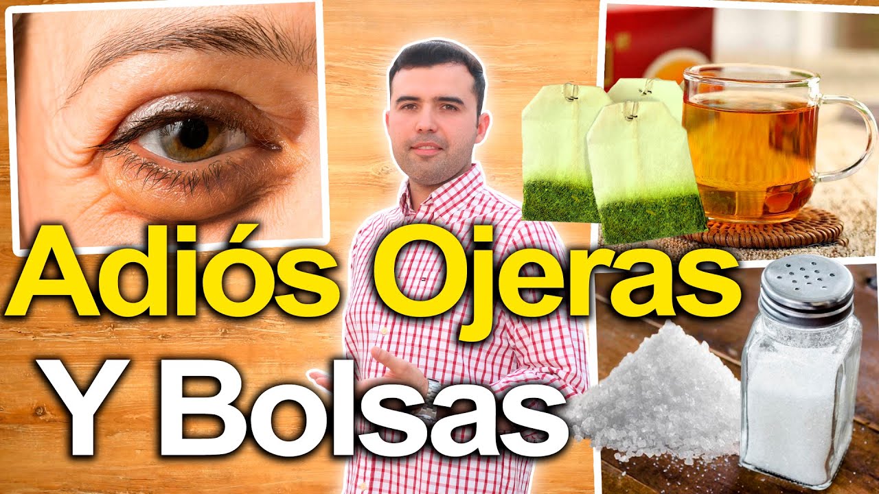 Descubre cómo la Vitacilina puede eliminar las ojeras de manera efectiva