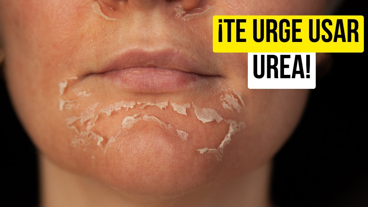 cremas con urea para la cara