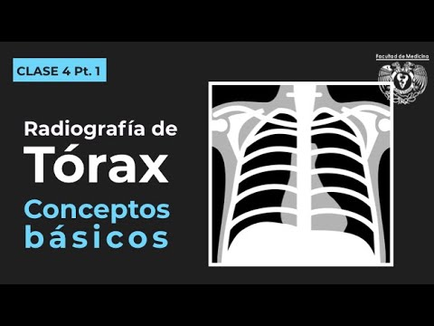 radiografía de tórax normal y anormal
