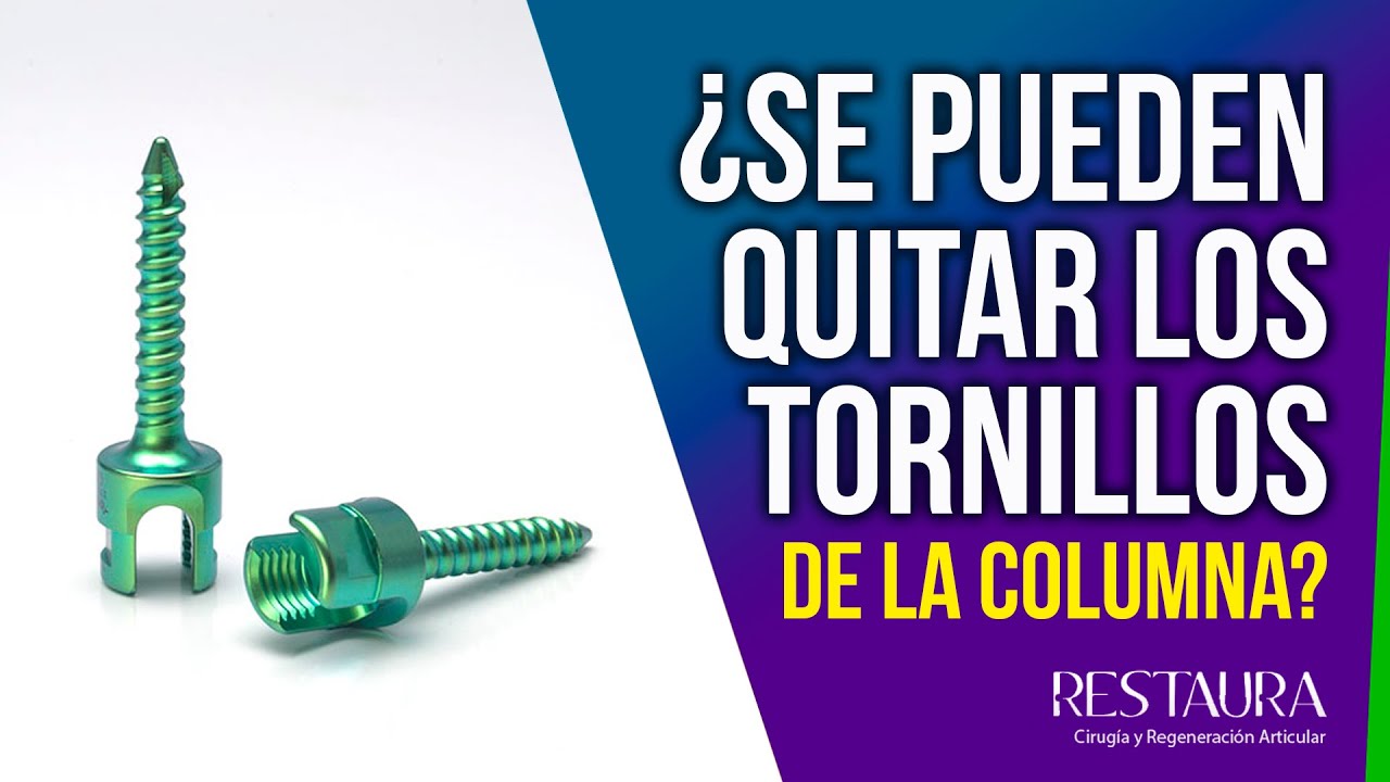 sintomas de rechazo de tornillos en columna