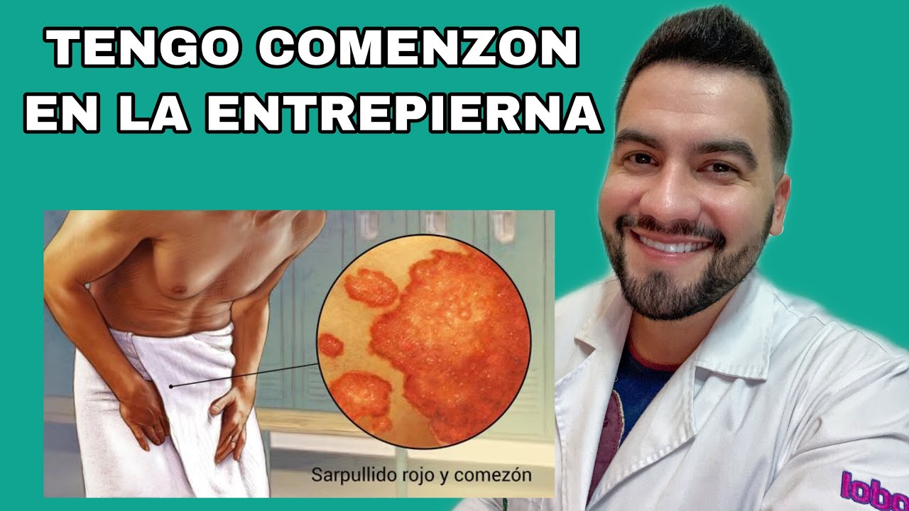 Causas y soluciones para la oscurecimiento de la piel en la entrepierna