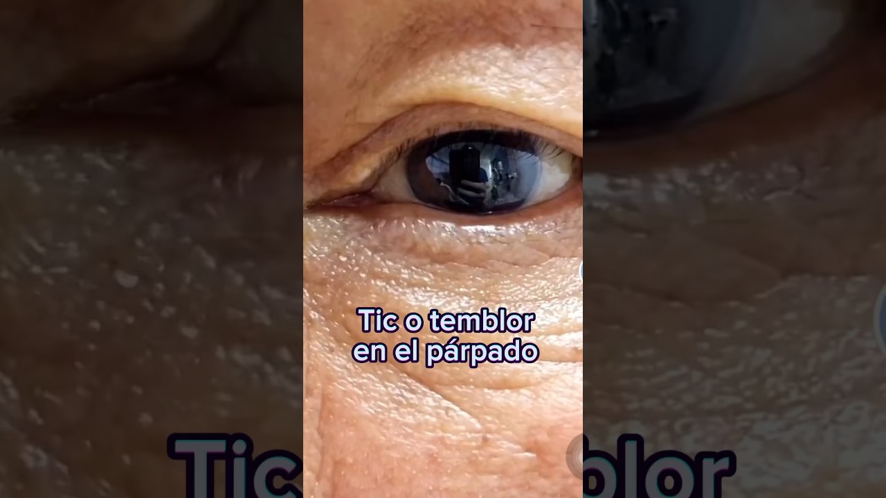 Descubre por qué te brinca el párpado: las posibles causas de este movimiento involuntario