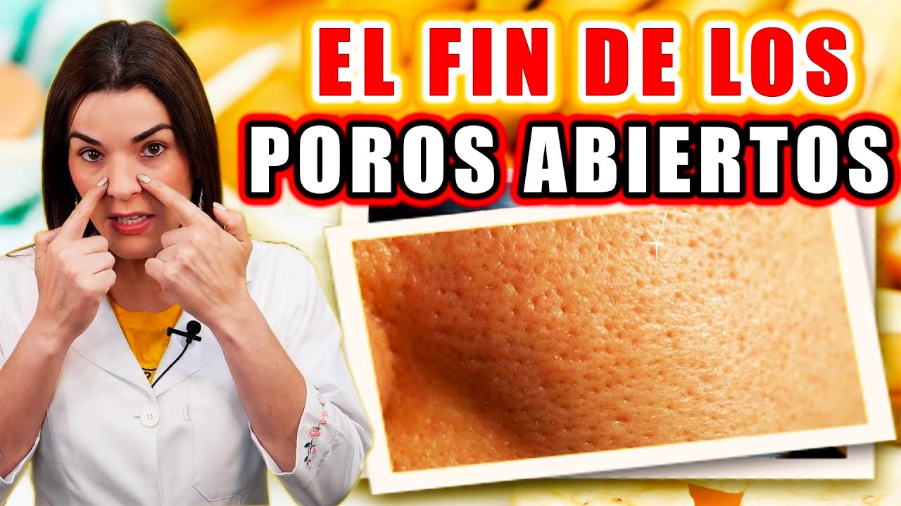 Remedios naturales para cerrar los poros del rostro