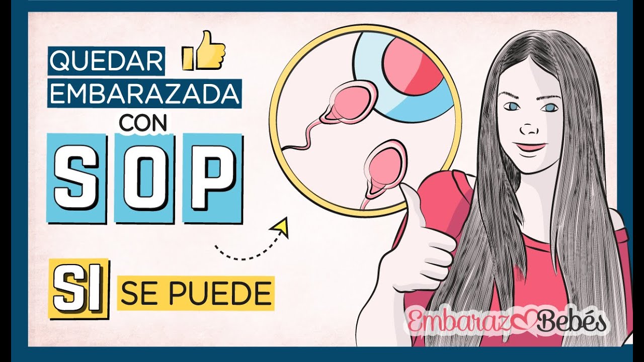 Tips para quedar embarazada si tienes ovarios poliquísticos