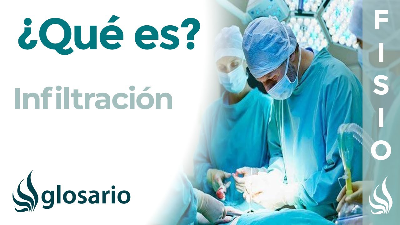 cuanto dura el efecto de una infiltracion