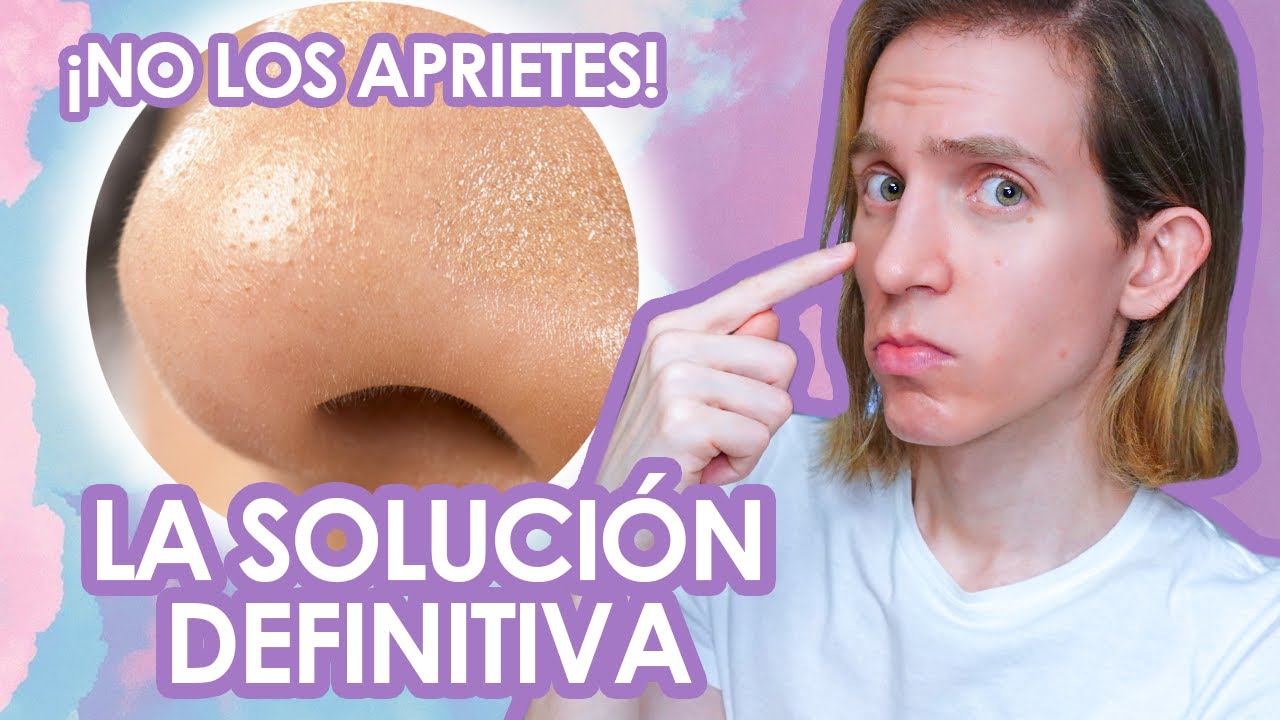 Cómo eliminar puntos de la nariz de forma rápida