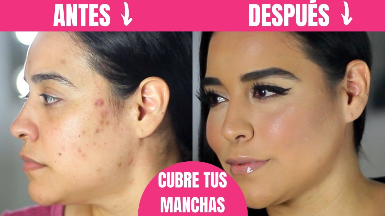 Cubre las manchas en tu cara con estos trucos