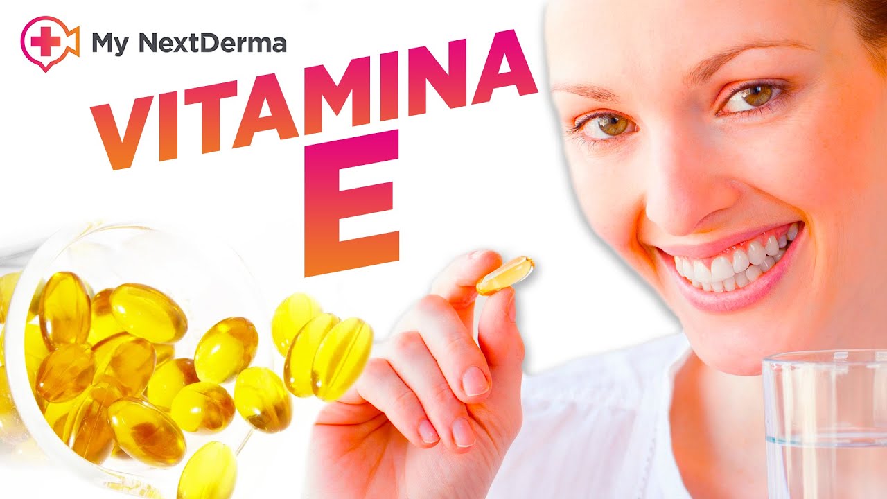 Descubre cómo combatir el acné con cápsulas de vitamina E
