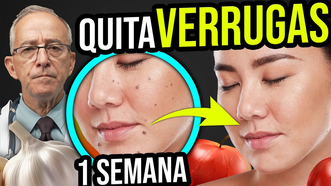 Truco casero para quitar un grano con ajo de forma efectiva