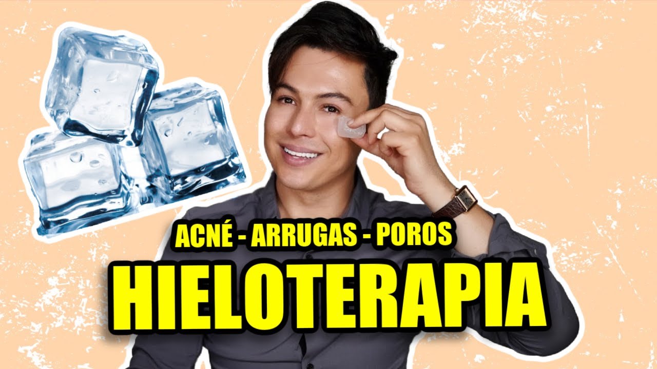 Trucos de belleza con hielo para combatir el acné