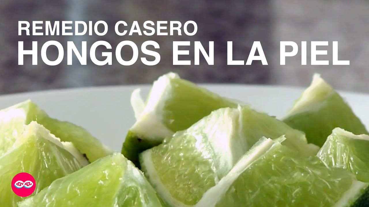 antimicotico para hongos en la piel
