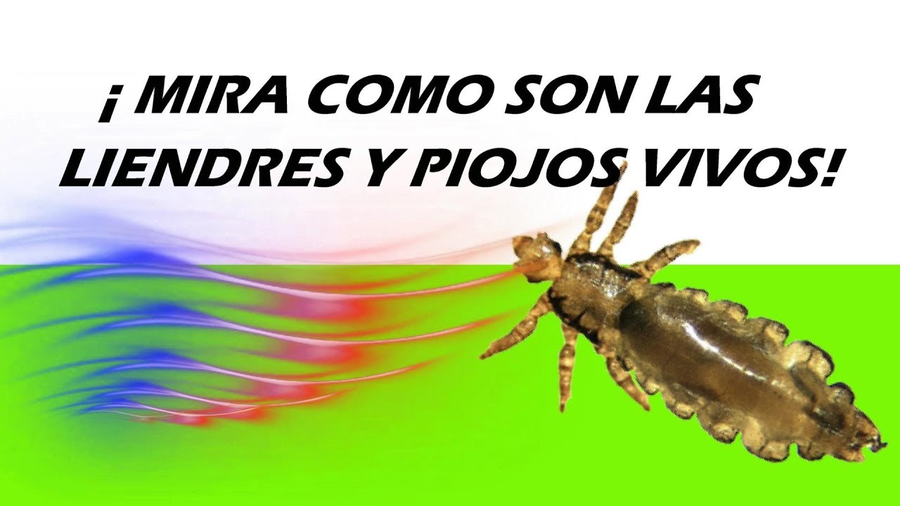 de q color son las liendres