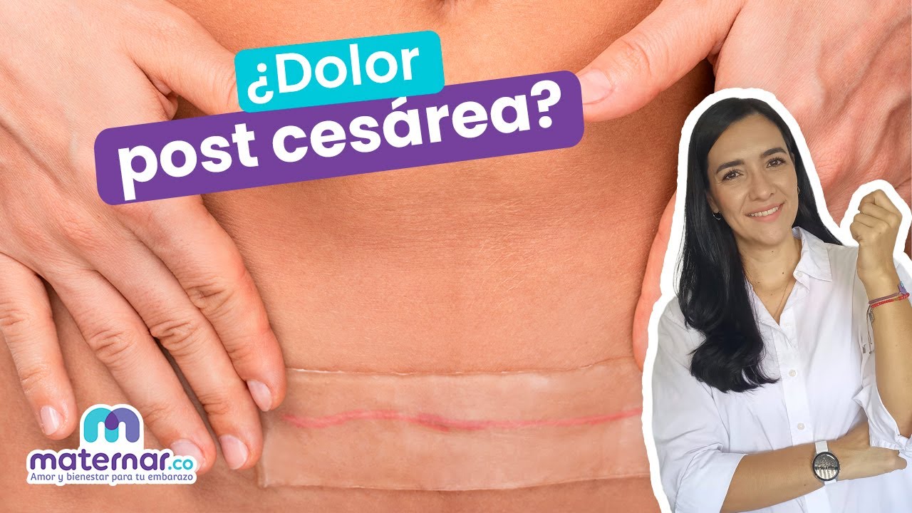 dolor abdominal al mes de una cesárea