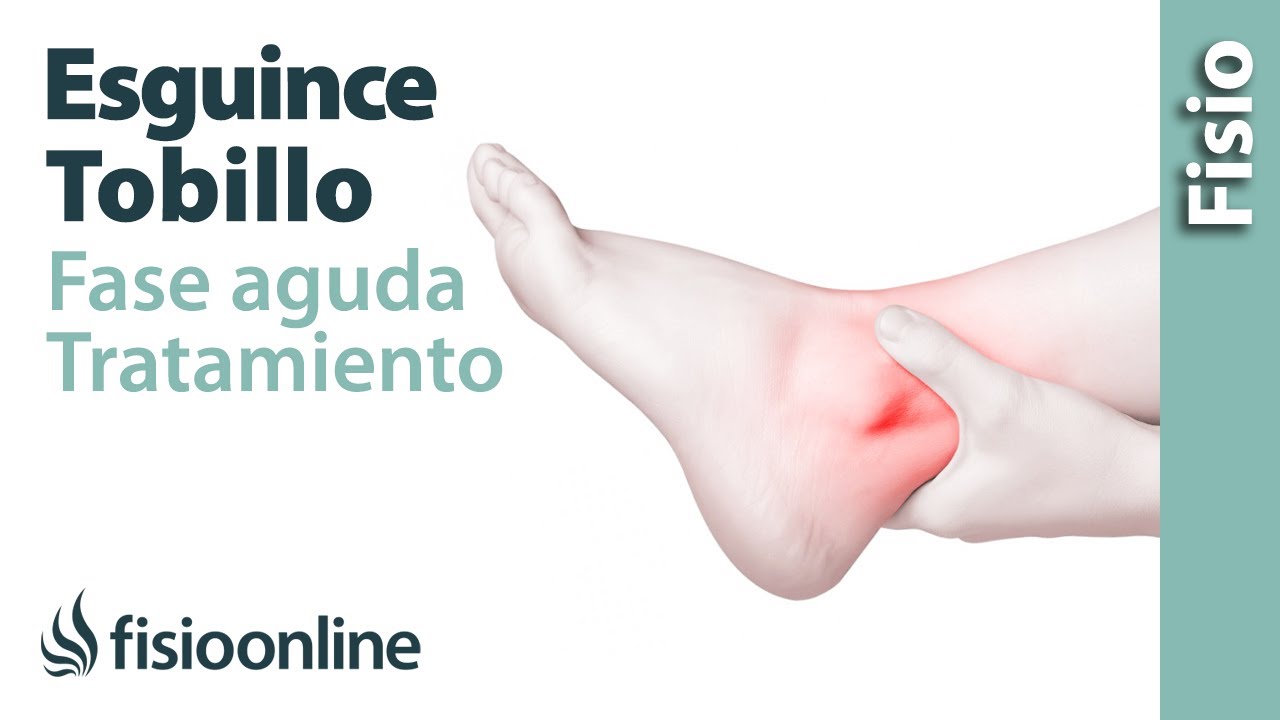 esguince grado 2 cuando se puede caminar