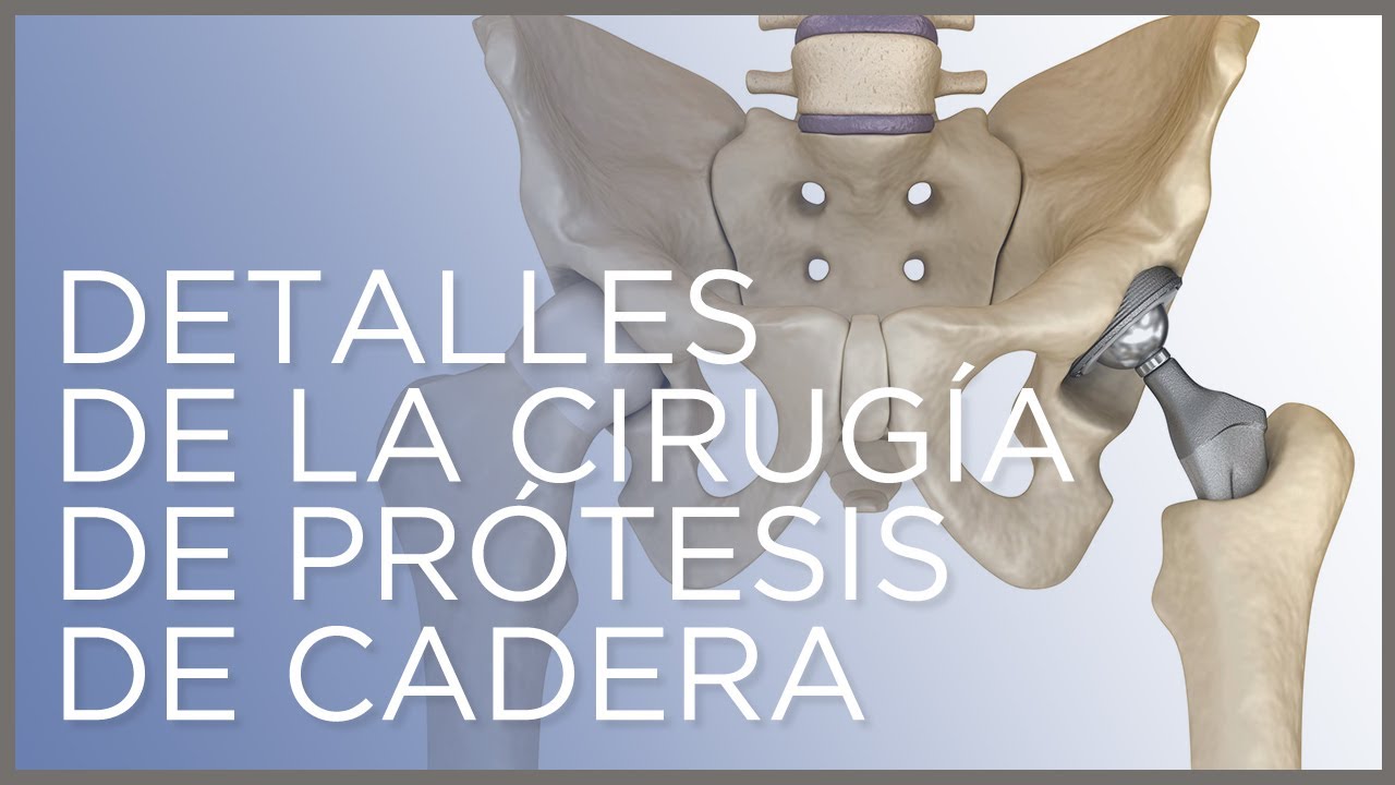 operación de cadera en personas mayores