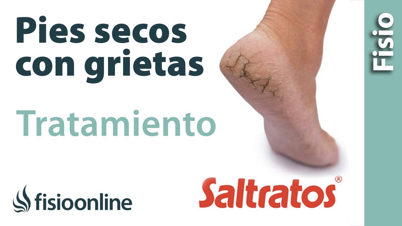 pomada para grietas en los dedos delos pies