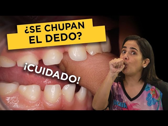 Cómo ayudar a los niños que se chupan el dedo