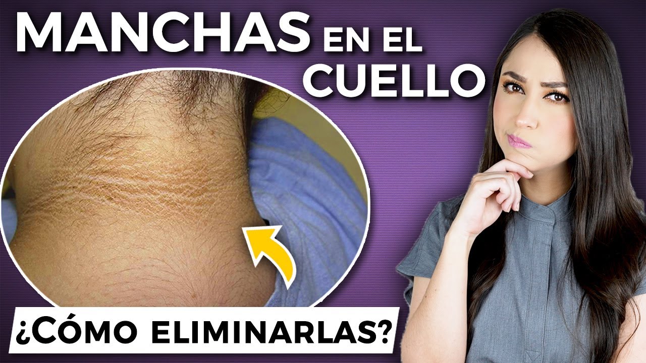 Cómo eliminar las manchas del cuello en solo un día