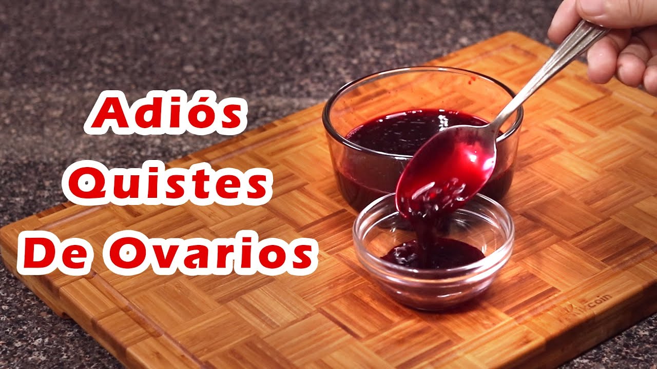 Cómo eliminar quistes en los ovarios de forma natural