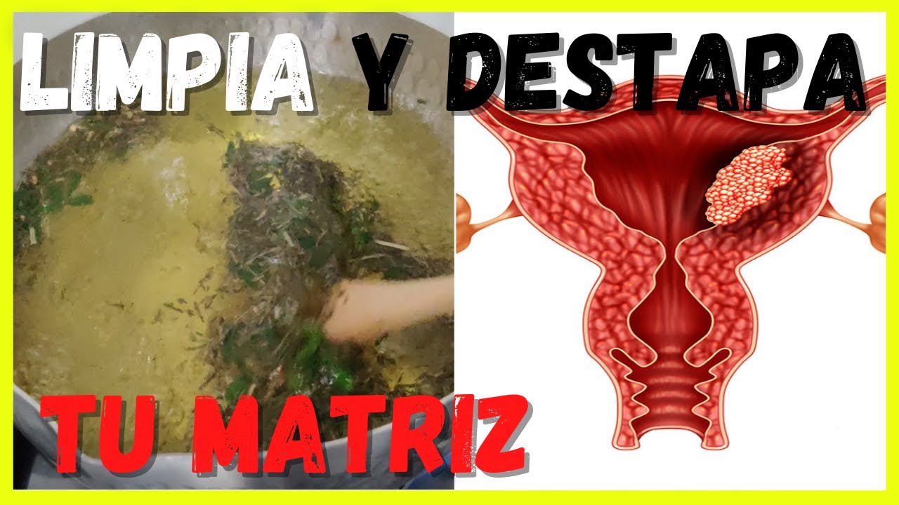 Cómo preparar un té de ruda para limpiar tu matriz de forma natural