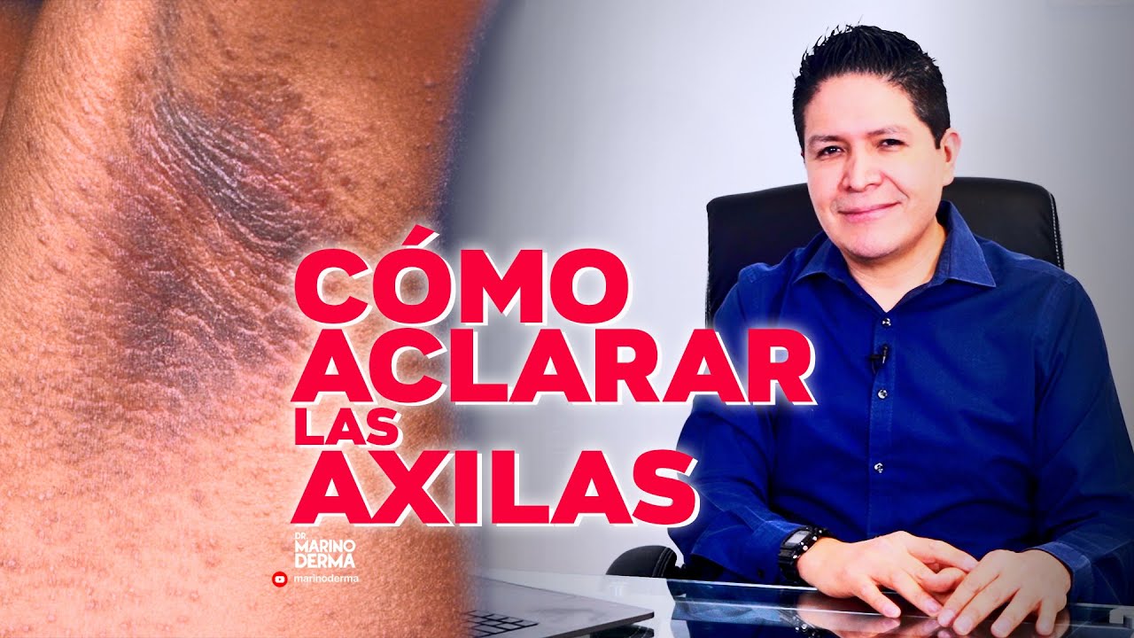Remedios caseros para eliminar las manchas oscuras de las axilas