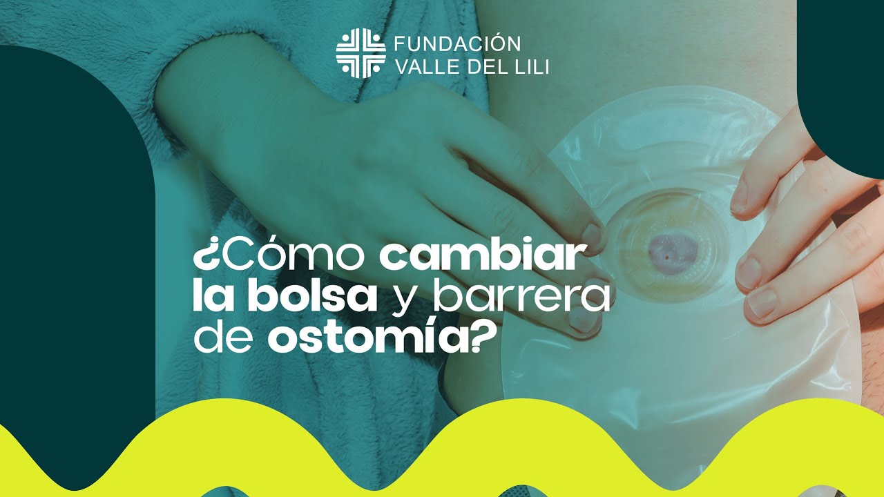 bolsa de colostomía abierta y cerrada