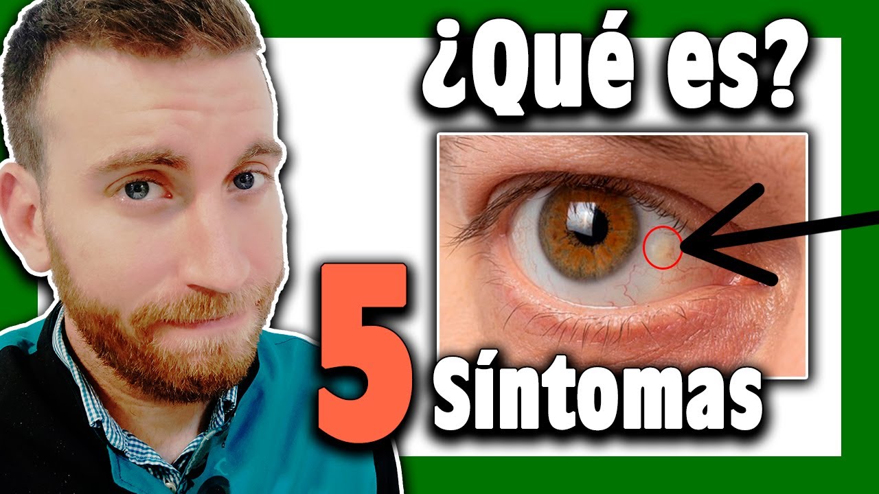 manchas en los ojos en la parte blanca