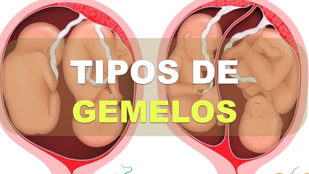 quien es el mayor de los gemelos