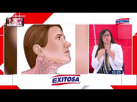cicatriz operación de ganglios en el cuello