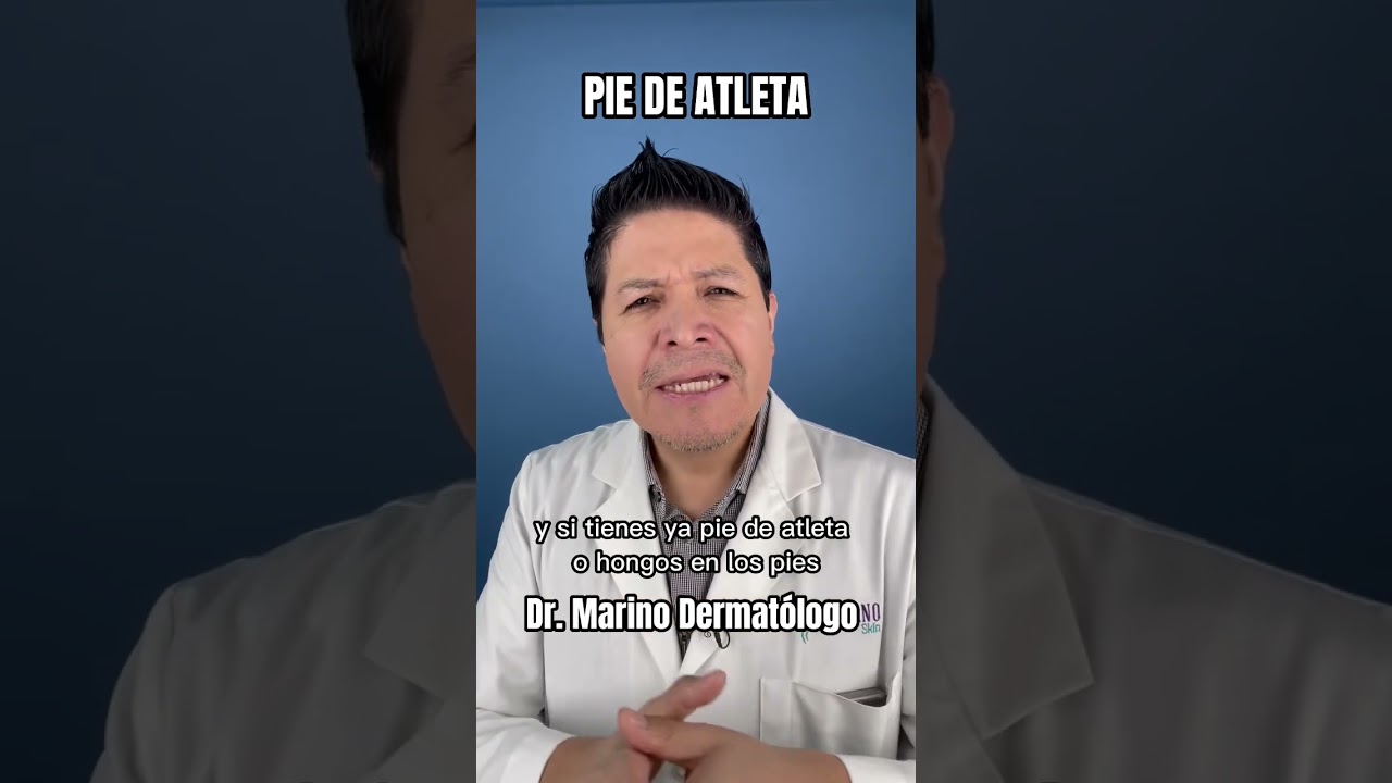 productos para hongos en los pies