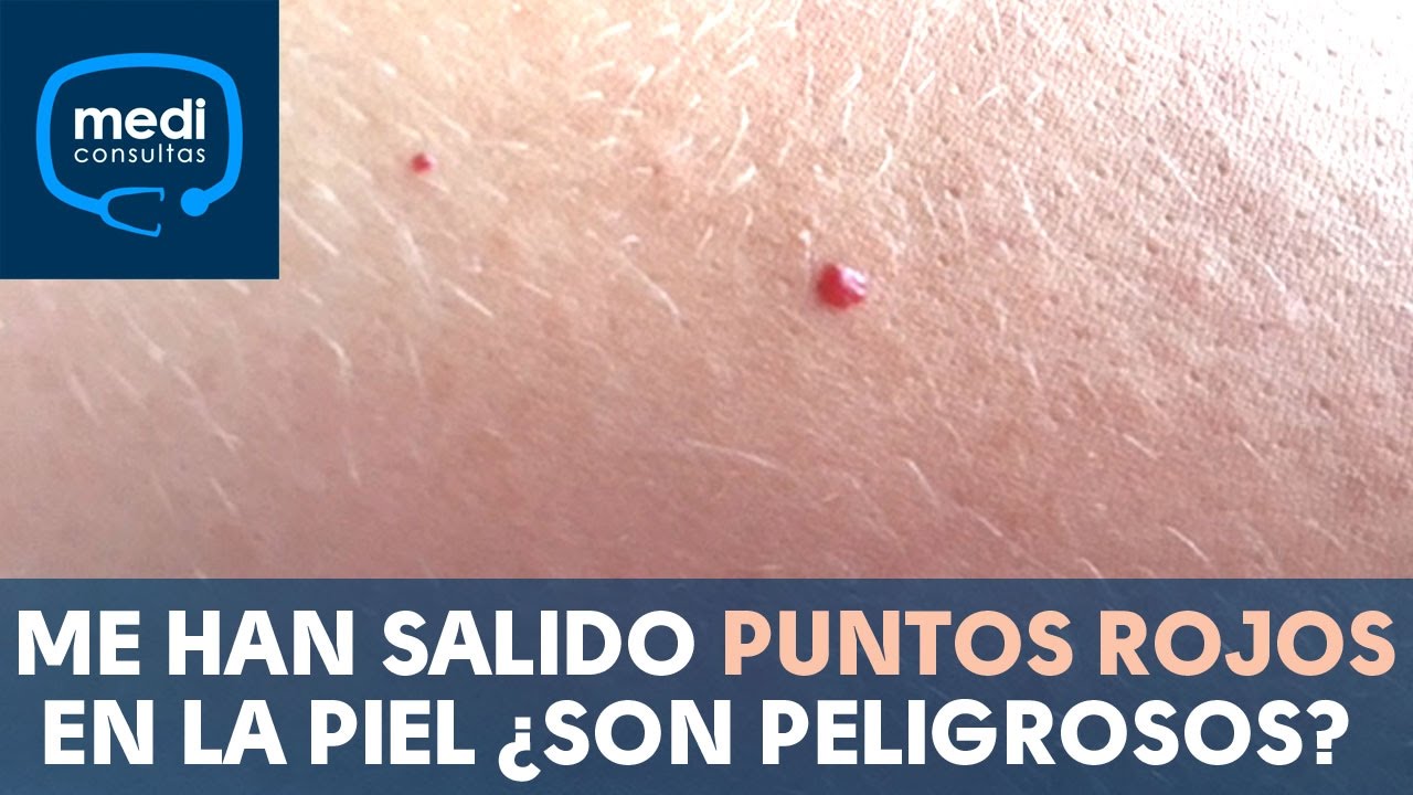 puntitos rojos en el cuero cabelludo